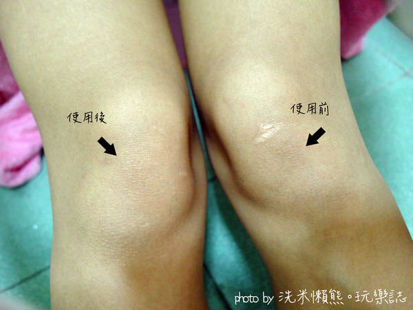 膝蓋測試.jpg